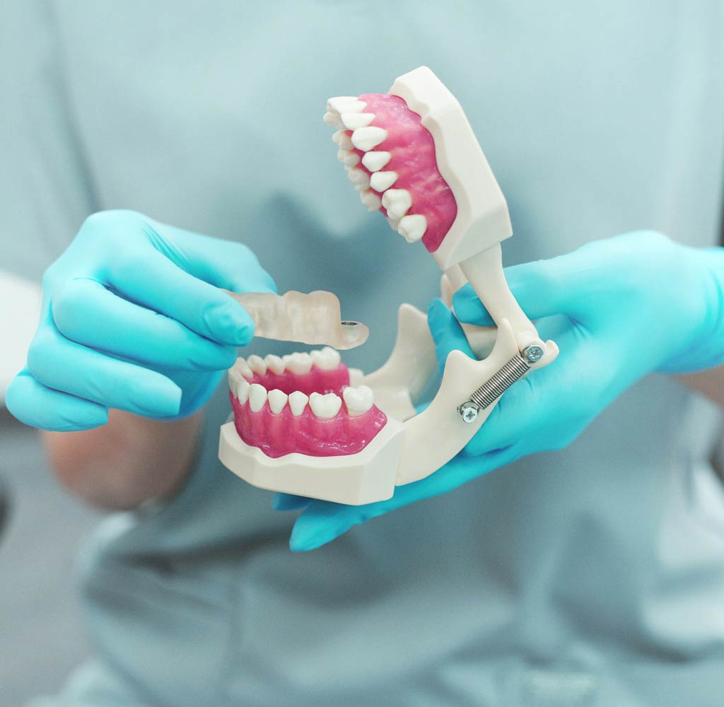רופא שיניים מחזיק מודל דנטלי, המציג יישור שיניים ואסתטיקה.